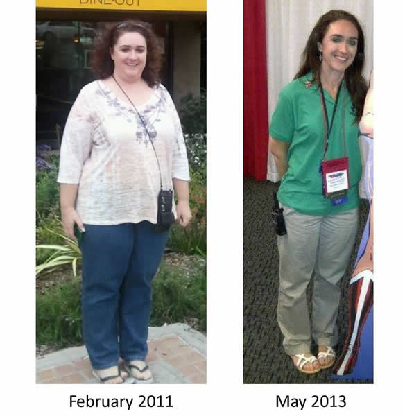 What Patients share about Mexicali Bariatric Center